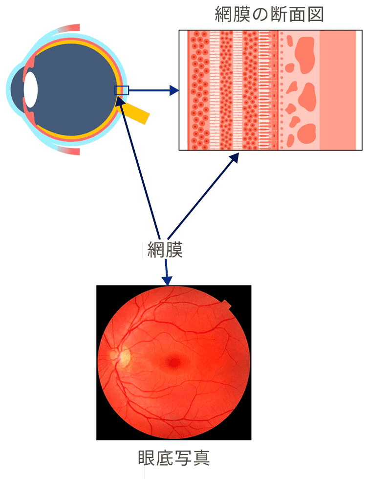 網膜の断面図