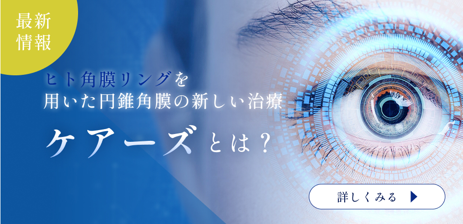ヒト角膜リングを用いた角膜円錐の新しい治療ケアーズとは