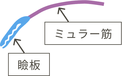 瞼板とミュラー筋