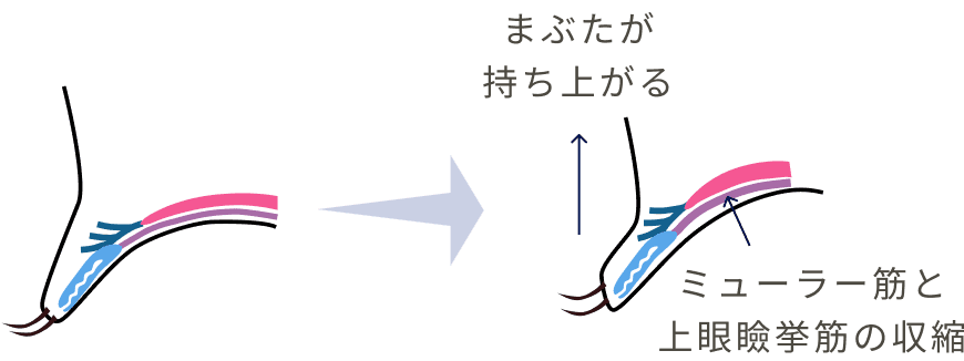 瞼が持ち上がる