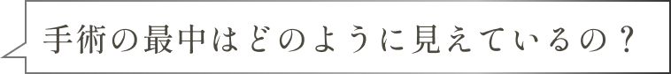 手術の最中はどのように見えているの?