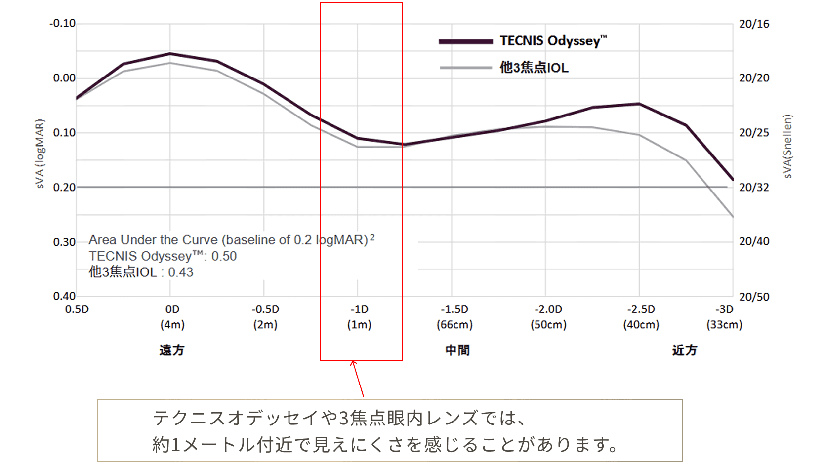 テクニス オデッセイや3焦点眼内レンズでは、約1メートル付近で見えにくさを感じることがあります。