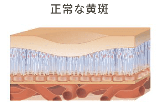 正常な黄斑