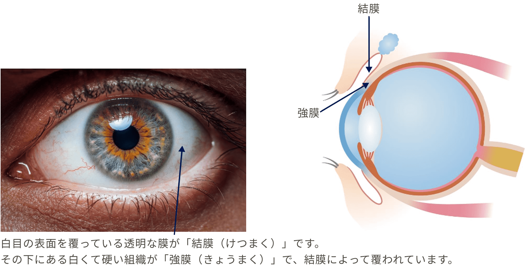 白目の表面を覆っている透明な膜が「結膜 (けつまく) 」です。その下にある白くて硬い組織が「強膜 (きょうまく) 」で、結膜によって覆われています。