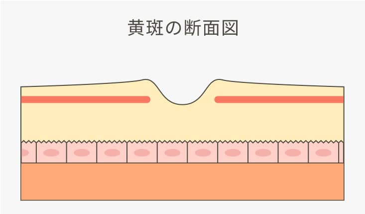 黄斑の断面