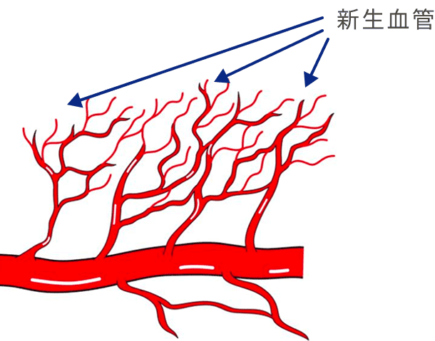 新生血管