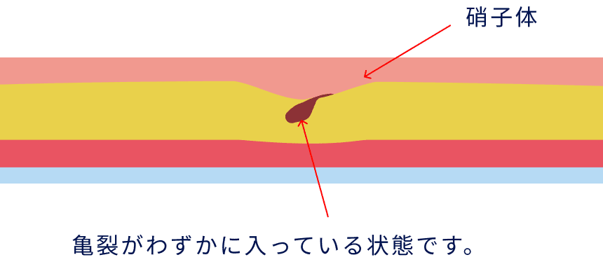 亀裂がわずかに入っている状態