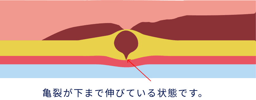 亀裂が下まで伸びている状態