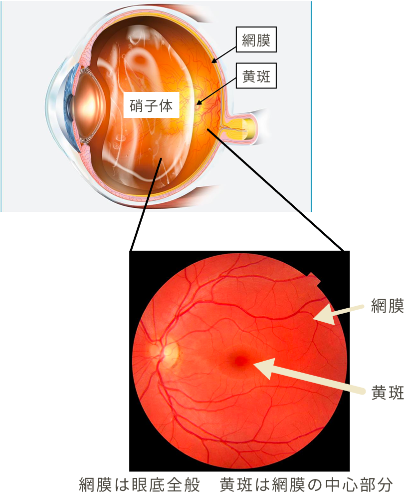網膜は眼底全般 黄斑は網膜中心部