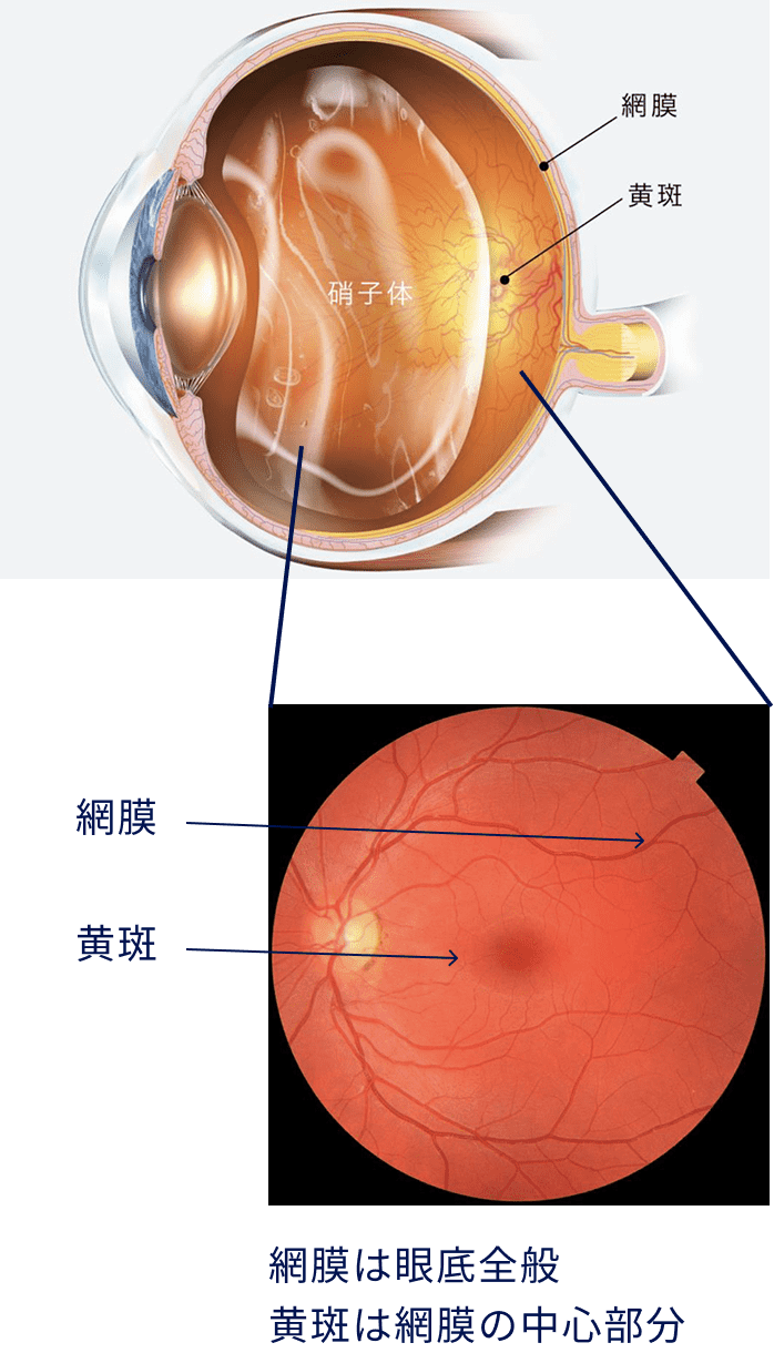 網膜は眼底全般 黄斑は網膜の中心部