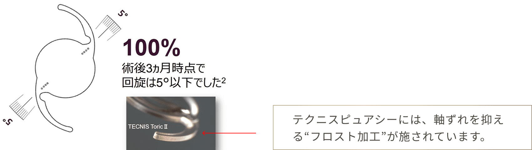 テクニス オデッセイは、軸ずれを抑える設計で回転しにくい
