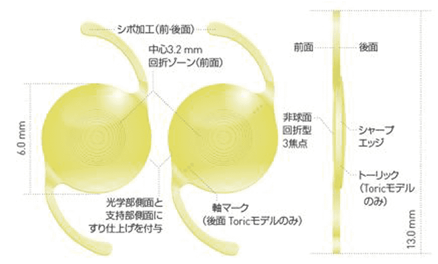 ジェメトリックレンズ
