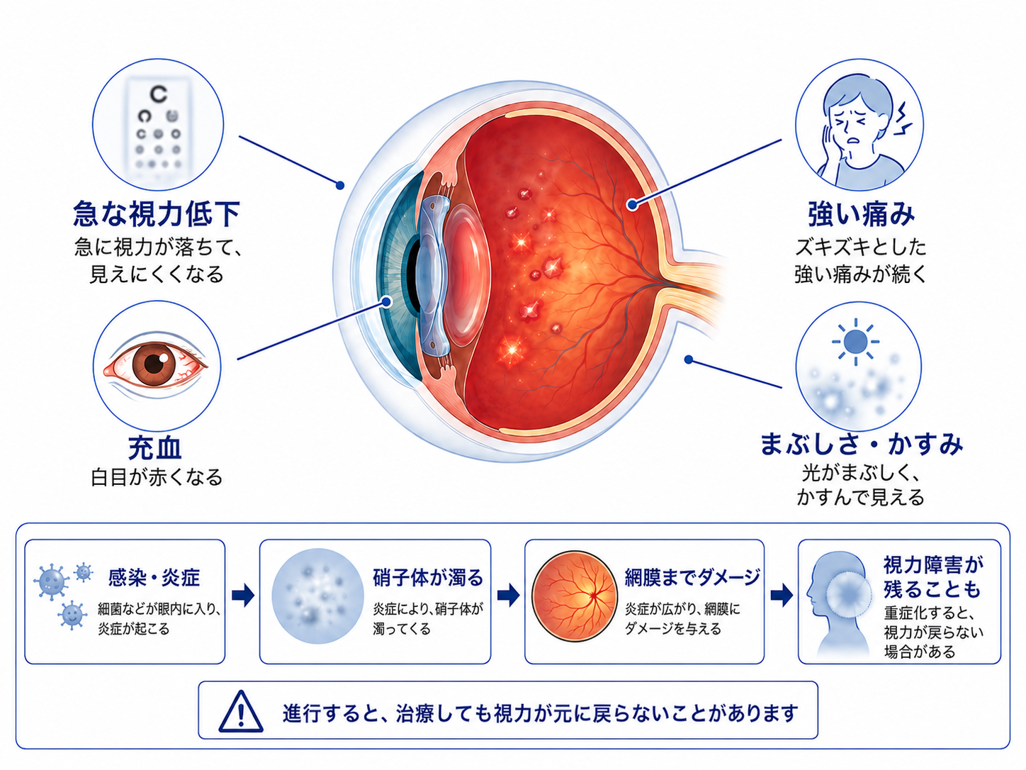 術後眼内炎の症状と眼内への影響